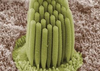 image of stereocilia in hearing loss