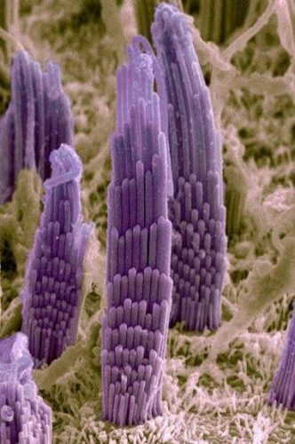 stereocilia image, these are damaged when people incur hearing loss and tinnitus