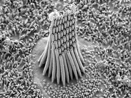 stereocilia, which are damaged in people with hearing loss and tinnitus